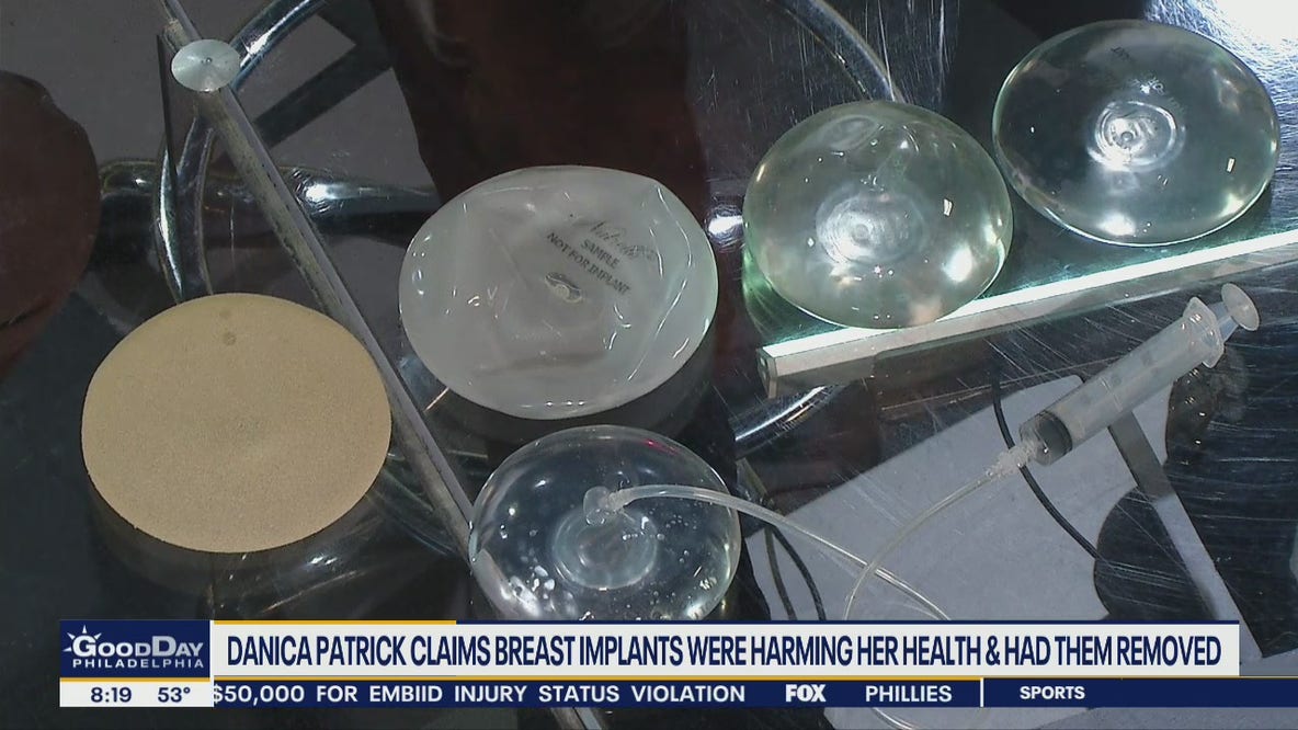 Local plastic surgeon talks Danica Patrick's bad reaction to breast implants